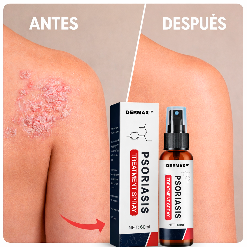 Alivio para la Psoriasis en Spray – DERMAX™