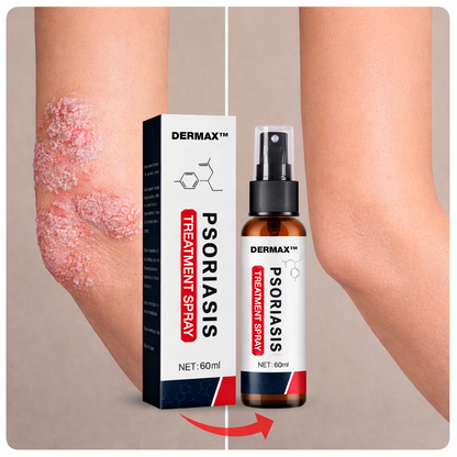 Alivio para la Psoriasis en Spray – DERMAX™